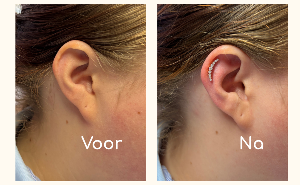 Helix piercing professioneel gezet met naald in Ommen Helix piercing professioneel gezet met naald in Ommen